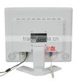 Hot and Best Digital Dental Unit 2016 Hot Sales Intraoral Camera With 3 Million-pixel thumbnail-4