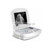 China Beijing 10.7 Inch Color LCD 2B Ultrasound Imaging System Laptop Ultrasound Scanner With CE ISO Approved thumbnail-5