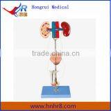Hot Sale Male Urinary Organ Anatomy Model