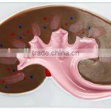 Nephron, Renal Corpuscle Model Demonstration Teaching Biological Science Instruments for Middle School Students