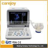 China Medical Ultrasonic Equipment pc Based Usb Ultrasound Scanner With Cheap Price thumbnail-1