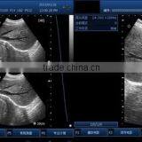 Best Price Pocket Ultrasonic Diagnostic Wireless Ultrasound Probe 10 Years Export Experience Supplier -WBU01 thumbnail-6