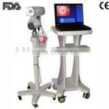 CE & ISO Approved Electronic Digital Video Colposcope on Sale thumbnail-1