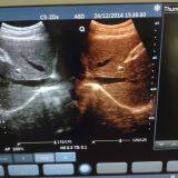 15'' Touch Screen High Resolution Portable Ultrasound Scanner Ultrasonic Diagnostic Device With Multi-frequency Probes thumbnail-2