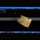 10.4 Inch Ultrasonic B Laptop Ultrasound Scanner With Battery Optional Printer thumbnail-5