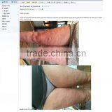 2015 Radio Frequency Rolling Guangzhou Beauty FSWT Machine Wholesaler thumbnail-2