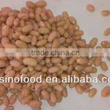 High Quality Canned White Kidney Beans With New Crop thumbnail-1