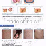 Stretch Mark Removal Medical CE Pigment Removal 30W Co2 Wrinkle Removal Fractional Machine With USA Coherent Laser thumbnail-3