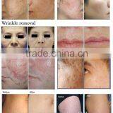 RF Pipe Fractional Co2 Carboxytherapy Laser Vaginal Tightening Machine Treat Telangiectasis thumbnail-5