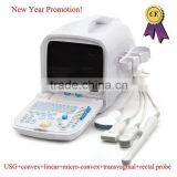 CE Approved Portable PC Ultrasound Scanner/Ultrasound Machine With 3.5Mhz Multi-frequency Convex Probe RUS-9000A thumbnail-1