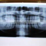 China KND-A/F CE Medical Dry Film Agfa Healthcare thumbnail-1