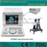 CE Approved Portable B-Mode Ultrasonic/ Ultrasound Scanner With 3.5Mhz Multi-frequency Convex Probe RUS-6000D thumbnail-5
