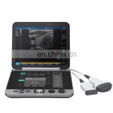 MY-A008A Notebook Touch Screen Panel Black and White Ultrasonic System Portable Full Digital Ultrasound Scanner