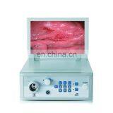 MY-P053 Endoscopic Camera Manually Adjust Brightness Medical Electronic Gastroscope Colonoscope Endoscopy System thumbnail-2