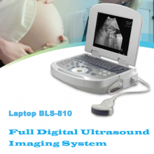 All Digital Ultrasonic Diagnosis SystemPortable Digital Acoustic Diagnostic Scanner for Human in Hospital thumbnail-5