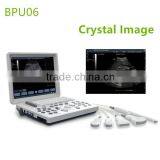 Excellent Laptop Ultrasound Machine for Sale- BPU06