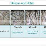 650nm Diode Laser Hair Growth Machine for Sale/Laser Hair Loss Treatment/ Collagen Hair Treatment thumbnail-6