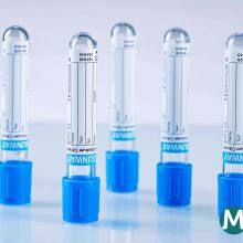 Vacuum Blood Collection Tube, Vacuum Tube, Vacutainer Blue Cap, Vacuum Blood Tube,Sodium Citrate Tube thumbnail-1