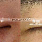 Skin Analysis System A-one With Pre-set Well Skin Analysis Software thumbnail-2