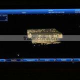 2016 New Laptop Ultrasound Machine / Scanner PC Platform With CE ISO Certification thumbnail-4