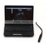 Laptop Veterinar Ultrasound Machine With Low Price thumbnail-2