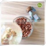 JSX Xinjiang Round Light Speckled Kidney Beans Dried Beans