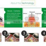 Ultrasonic Cavitation Body Sculpting High Quality Vacuum Cavitation Body Slimming Machine System Slimming Machines 1MHz thumbnail-3