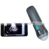 UProbe-1 Wireless Probe Ultrasound Scanner thumbnail-2