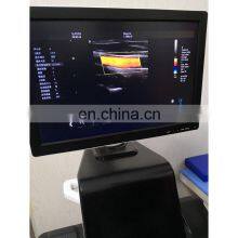 2020 Hot Sale Popular CE Certificate 4D Trolley Color Doppler Ultrasound Machine thumbnail-2