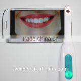 Newest 5 Mega-pixel Family Oral Examination Multi-functional Best Selling Lcd Monitor 720P Wifi Intraoral Camera thumbnail-1