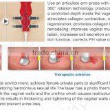 Vaginal Tighten Fractional Co2 Laser Vaginal Tightening thumbnail-4