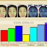 Portable Dialysis Machine/facial Skin Analyzer Machine Skin Scan/skin Analyser for Face thumbnail-5