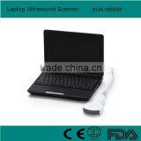 Laptop Ultrasound Machine / Scanner 10 Inch Monitor RUS-9000F Manufacturer thumbnail-1