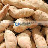 Commercial Turnip Fruit Vegetable Washing and Peeling Potato Ginger Washer and Peeler Machine thumbnail-4