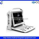 Ultrasound Linear Probe thumbnail-1