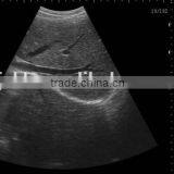 CE Approved Laptop Ultrasound Scanner With 3.5Mhz Multi-frequency Convex Probe RUS-9000F thumbnail-2