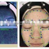 Skin Analyzer and Quantum Resonance Magnetic Analyzer Supplier thumbnail-5