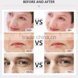 RF Anti Aging Skin Treatment Skin Rejuvenation Equipment thumbnail-6