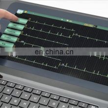 hospital necessary portable ecg machine with 12 leads 12 channels ECG