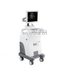 Portable Medical Ultrasound Instruments 15 Inch B/W Full- Digital 2D Ultrasound Trolley Ultrasound Scanner Machine thumbnail-4