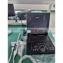 HC-A013C Factory Direct Portable 3D Color Doppler Ultrasound Machine 12 Inch LCD Display Laptop Ultrasound Diagnostic System thumbnail-4