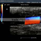 Laptop Color Doppler Ultrasound Syatem With Transducers thumbnail-4