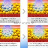 RF Vacuum Roller Machine Skin Lifting Ultrasonic Cavitation Facial Machine Price Ultrasound Weight Loss Machines thumbnail-5