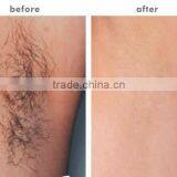 Tattoo Removal System 2016 Latest Professional Multifunctional Ipl Shr Laser System Pigmented Lesions Treatment Nd Yag Laser Hair And Tattoo Removal Beauty Machine thumbnail-5