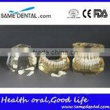 Dental Detachable Transparent Dentition Model DEA-47