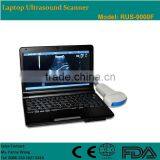 CE Approved Laptop Ultrasound Scanner RUS-9000F With 3.5Mhz Convex Probe and 7.5Mhz Linear Probe thumbnail-1