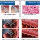 Professional Fractional Co2 Laser Vagina Co2 Fractional Laser VH613 thumbnail-5