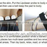 NV-650A Professional Portable Laser Therapy Machine thumbnail-6