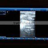 Laptop 3D Ultrasound Machine for Vet Use thumbnail-5