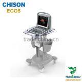 Cheapest Price ECO5 Color Doppler 3D 4D Portable Ecografo Chison for Sale